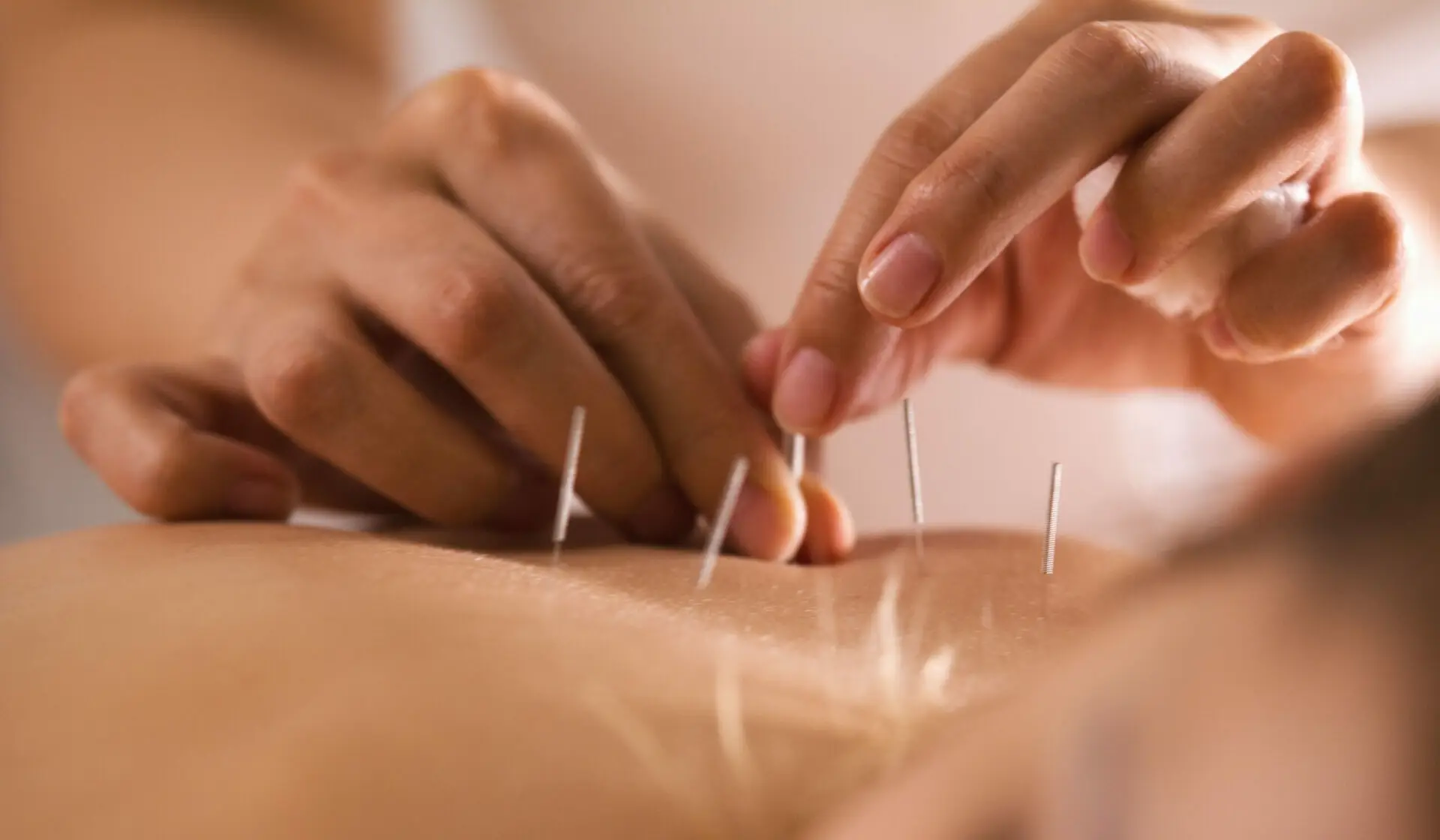 The,Doctor,Sticks,Needles,Into,The,Girl’s,Body,On,The